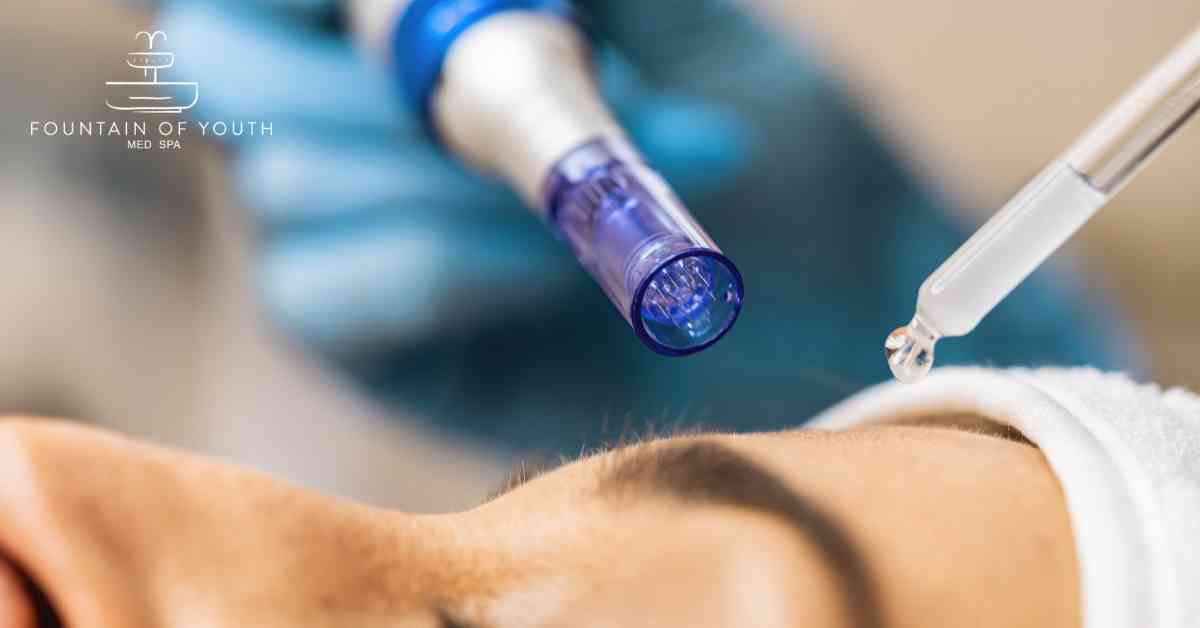 Does Brand Matter for Microneedling?